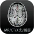 Ӱ�����ͼ�������ֻ���v4.5.8 �ٷ�����